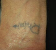 Tatuiruotė paruo&scaron;ta &scaron;alinimui lazeriu