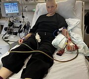 Su agresyvia limfomos forma kovojanti Dovilė
