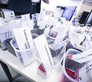Santaros klinikų maisto tiekimo akimirka. Dietų įvairovė