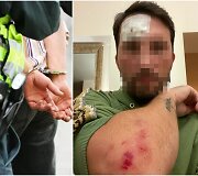 Paspirtuko vairuotojo konflikto su policijos pareigūnais padariniai