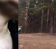 Nepilnametis užpuolė merginą Tauragės mi&scaron;ke