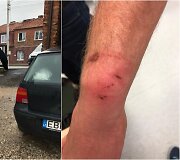 Kaunietis teigia, kad policijos pareigūnai prie&scaron; jį neteisėtai panaudojo jėgą