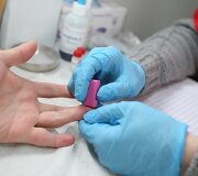 Europos aik&scaron;tėje siūloma nemokamai pasidaryti greitąjį ŽIV testą.