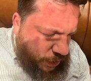Leonidas Volkovas po užpuolimo 