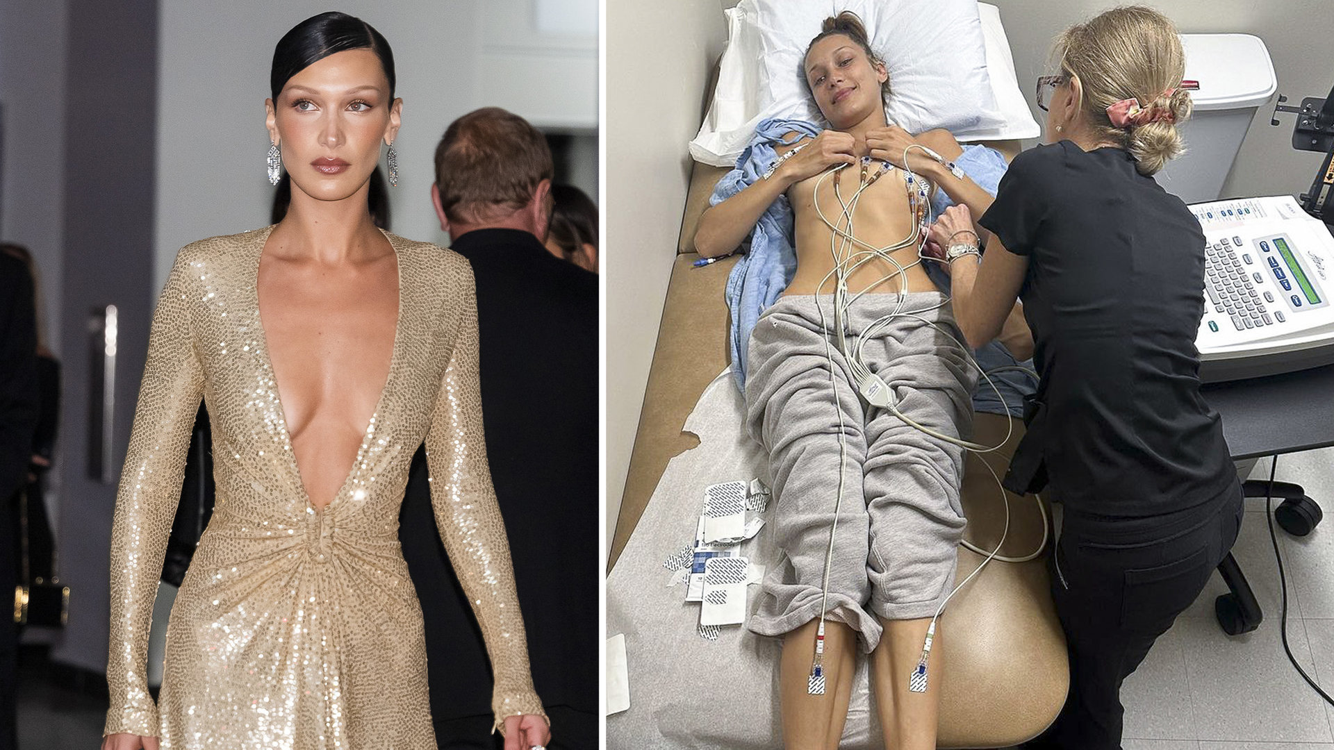 Bella Hadid / Getty ir Vida Press nuotraukos