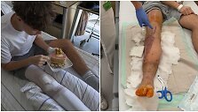 Paauglio Adriano kova už i&scaron;saugotą koją &ndash; tik įsibėgėja