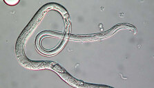 Strongyloides stercoralis, mastelio žymeklio dydis &ndash; 30 mikrometrų