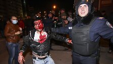 Doneceke sužeistas protestuotojas