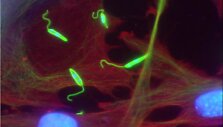 Leishmania major (žalia spalva) &scaron;eimininko ląstelėse (raudona spalva žymi citoplazmą, mėlyna &ndash; branduolius)