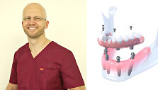 Vakarieti&scaron;ka implantacija Lietuvoje. Kokias metodikas atvežė gydytojas?