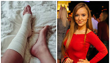 Monika &Scaron;alčiūtė ir jos patempta koja
