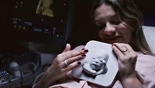 Akla būsima mama Tatjana &bdquo;pamato&ldquo; savo dar negimusį sūnų