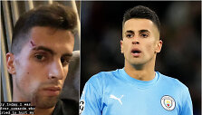 Joao Cancelo buvo apiplė&scaron;tas ir sužeistas