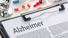 Diagnozė &ndash; Alzheimeris