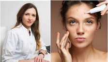 Jolita Kvizikevičiūtė-&Scaron;takonienė apie vėjaraupius suaugusiame amžiuje
