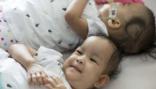 Australia_Conjoined_Twins_43044.jpg-fadac