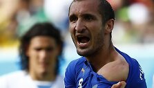 Giorgio Chiellini rodo ant peties likusias Urugvajaus futbolininko Luiso Suarezo kandimo žymes