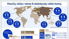 Plaučių vėžio statistika gąsdina labiausiai