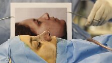 Irane atliekamos nosies plastinės operacijos