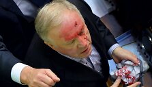 Ukrainos parlamente per mu&scaron;tynes sužeistas deputatas