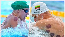 Europos plaukimo čempionate dalies plaukikų, tarp jų Rūtos Meilutytės ir Andriaus &Scaron;idlausko, kūnus žymi vaakuminių taurių paliktos žymės. 