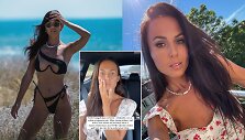 Ieva Swan pasidalijo perspėjimu apie &scaron;alutinį botokso poveikį
