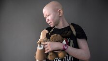 Į Niujorką i&scaron; Tanzanijos atgabenti albinosai
