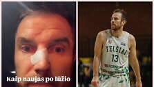 &bdquo;Tel&scaron;iams&ldquo; atstovaujantis Martynas Gecevičius patyrė nosies lūž&scaron; per NKL rungtynes.