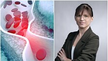 Laura Luko&scaron;iūnienė ir cholesterolio vizualizacija