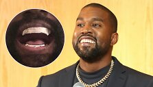 Kanye Westas