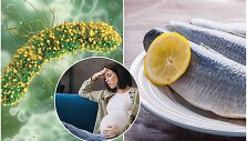 Listeria monocytogenes sukeliama infekcija ypač pavojinga nė&scaron;čiosioms ir naujagimiams