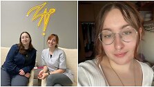 Amanda pasidalino savo kova su veido plaukuotumu