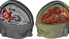 Smegenų palyginimas &ndash; kairėje pusėje &ndash; įprastai dirbančios žmogaus smegenys,de&scaron;inėje &ndash; paveiktos LSD