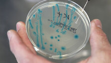 E.coli bakterijos tyrimai