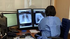 Tuberkuliozės atvejų &scaron;alyje pastaraisiais metais vis mažėja: tai gali lemti ir pagerėjęs i&scaron;ai&scaron;kinimas, ir finansavimas.