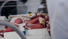 Antradienį gimusios mergytės auga inkubatoriuje