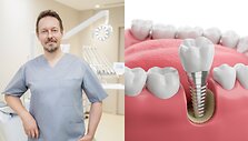 Kairėje &ndash; Doc. med. dr. Linas Zaleckas, &bdquo;Denticija&ldquo; nuotr. De&scaron;inėje &ndash; Dantų implantai, &bdquo;Shutterstock&ldquo; nuotr.