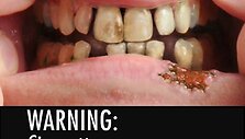 JAV administracijos siūlomos nuotraukos cigarečių pakeliams