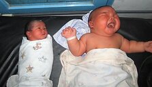 Sunkiausias Indonezijoje gimęs kūdikis, sveriantis 8,7 kg, guli &scaron;alia vidutinio dydžio kūdikio.