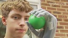 Matthew Jamesas ilgus metus svajojo įsigyti bioninę ranką.