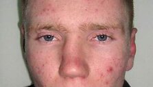 Policijos ie&scaron;komas Dominykas &Scaron;čeglovas, kuris įtariamas nepilnametęs i&scaron;prievartavimu.