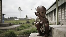 Prognozuojama, kad Nigeryje nuo bado gali mirti 400 tūkst. vaikų