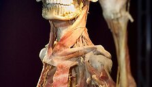 Parodos &bdquo;The Human Body Exhibition&ldquo; eksponatas
