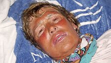 Medūzų sugelta Diana Nyad