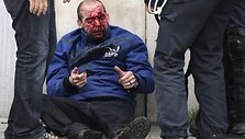 Sužeistas protestuotojas