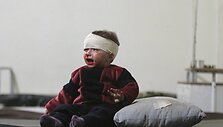 Damaske per raketų sprogimus sužeistas berniukas