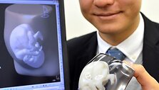 Tomohiro Kinoshita su trimačiu vaisiaus modeliu