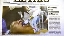 Ispanų laikra&scaron;tyje &bdquo;El Pais&ldquo; publikuota suklastota sergančio Hugo Chavezo nuotrauka