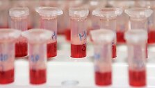 В США люди начали умирать от неизвестной болезни
