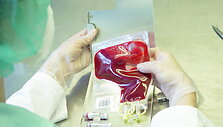 Dažniausiai negrįžtamai kepenis sužalojantis hepatito C virusas pramintas &bdquo;tyliuoju žudiku&ldquo;. 